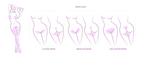 Borders for hair removal: Classic bikini, Brazilian bikini, Hollywood bikini. Areas for hair removal, female epilation, depilation for girls.