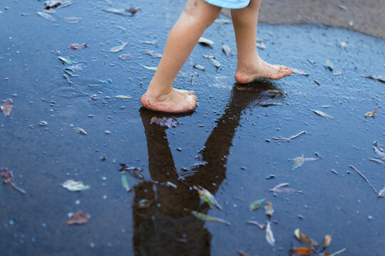 feet of child with club foot walking on wet pavement
