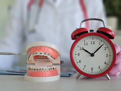 Preparing the dentist for orthodontic treatment braces and teeth and alarm clock