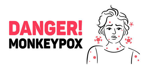 Increasing Awareness of Monkeypox Essential Health Precautions and Recognizing Symptoms. An educational graphic highlighting monkeypox symptoms and dangers to raise public awareness effectively