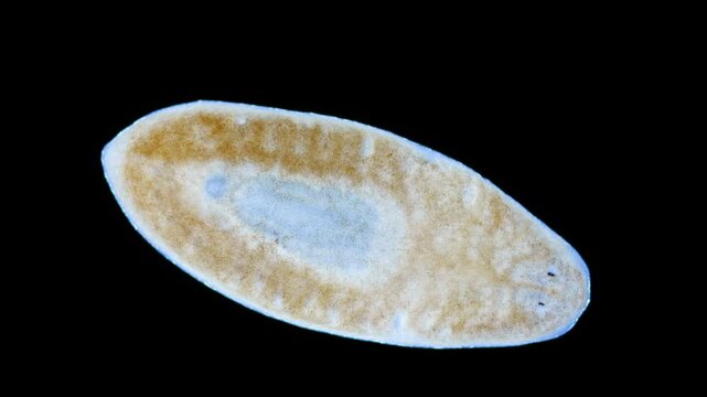 Flatworm Uteriporus vulgaris under a microscope, order Tricladida, Platyhelminthes phylum. Sample found in White Sea