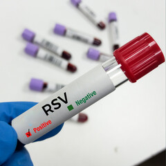 Blood sample for RSV (respiratory syncytial virus) test, Rapid RSV antibody test. common respiratory virus that usually causes mild, cold-like symptoms