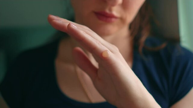 Close up second-degree burn of woman finger with hot water. Hand skin puffed up into balls