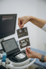 Doctor is holding results of ultrasonic test in hands