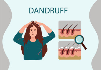 Young woman with dandruff problem.Health medicine, trichology, dermatology concept. Vector hand drawn flat cartoon illustration.