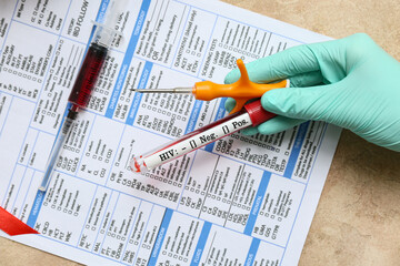 Doctor with HIV blood test tube and laboratory report form on beige grunge background