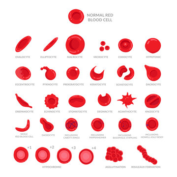 Poikilocytosis of Erythrocytes Shape of red blood cell. Sickle cell, Echinocyte, Spherocyte, Elliptocyte, Acantocyte, Stomatocyte, Dacrocyte, Target cell and Normal Erythrocyte.
