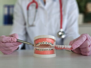 Orthodontist demonstrating braces treatment using a dental model