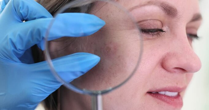 Dermatologist analyses cheek skin with magnifying glass. Doctor identifies imperfections evaluating face skin in healthcare environment