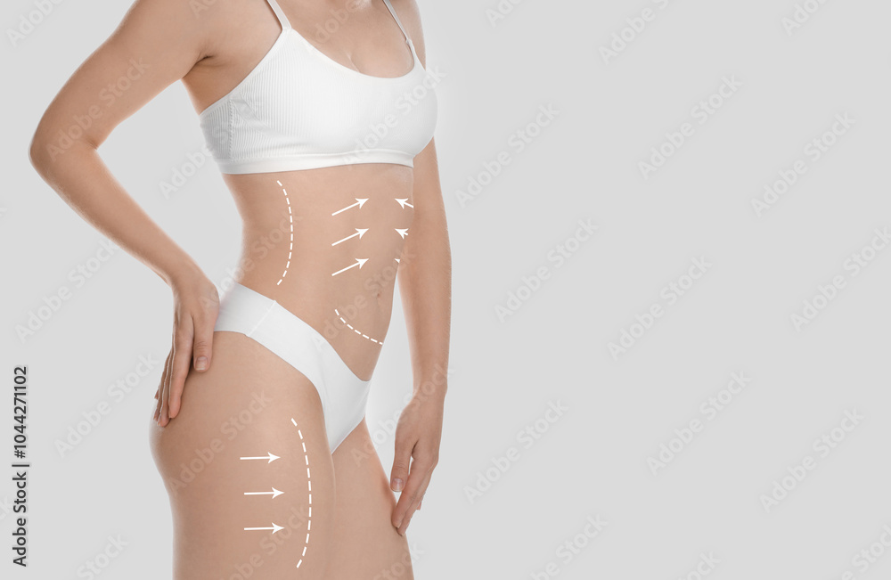 Sticker Woman with perfect slim body on light grey background, closeup. Figure correction arrows and lines on skin