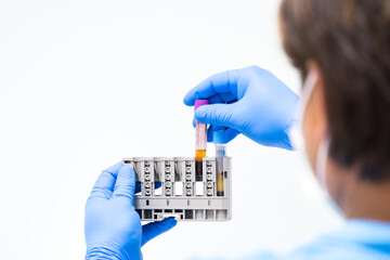 Doctor hand wearing blue gloves taking and checking blood sample tubes from a rack with machines of analysis in the lab on white background.Technician and blood test tube at lalaboratory unit.