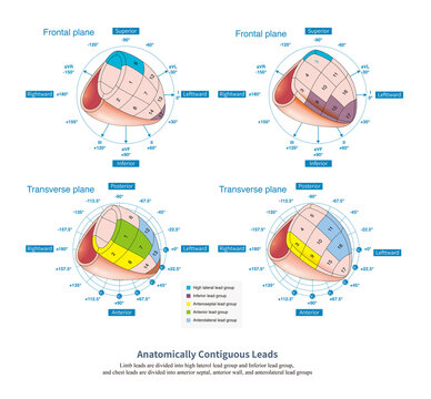 On the electrocardiogram, the range of the myocardium is explored based on the leads, and some leads are grouped according to myocardial anatomy to form anatomically contiguous leads.