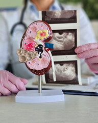Urology and treatment of kidney diseases