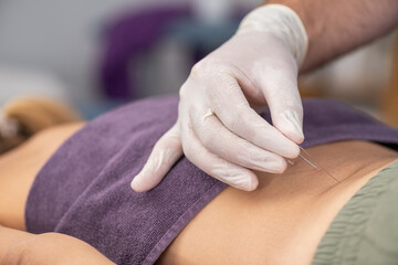 Physical therapist performing dry needling on a patient's back to relieve muscle pain, improve flexibility, and promote healing through targeted trigger point therapy