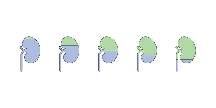 Chronic Kidney Disease (CKD) Stages Scientific Design. Vector Illustration.

