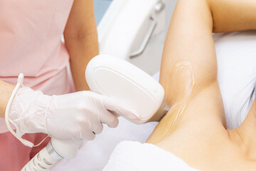 Armpits laser treatment. Close up shot of a young woman having armpits hair removed with a laser hair removal machine by a professional beauty therapist at the beauty spa salon depilation epilation