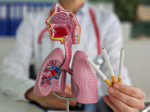 Doctor demonstrates the dangers of smoking using a model lung with cigarettes