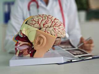 Ultrasound of the cerebral vessels. MRI digital x-ray of brain with radiologist oncologist