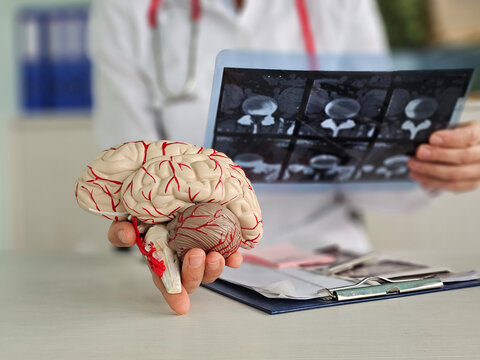 Doctor checks x-ray of brain using ST segment scanning. MRI of brain. Electroneuromyography