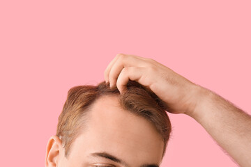 Young redhead man with hair loss problem on pink background, closeup