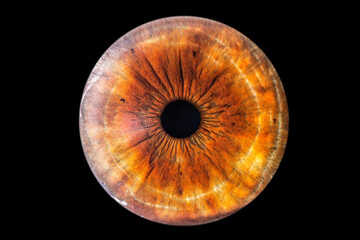 Iride con pupilla piccola