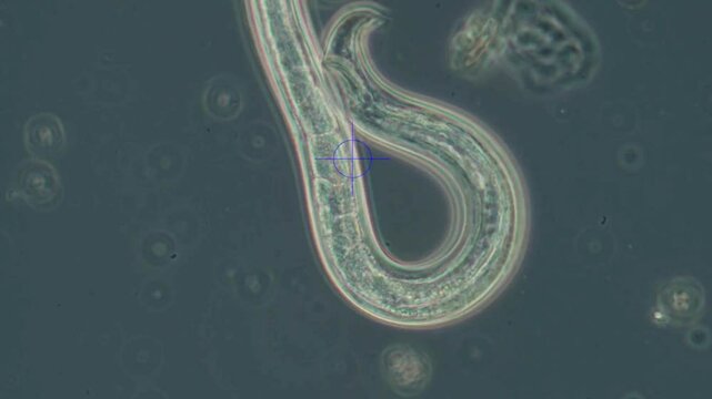 Curves of a nematode photographed under a microscope in a laboratory. Study of worms and roundworms.