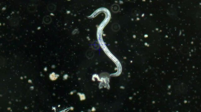 A large magnified nematode worm bends under microscope magnification. Studying parasites with a microscope. Diagnosing parasitic forms of infection.