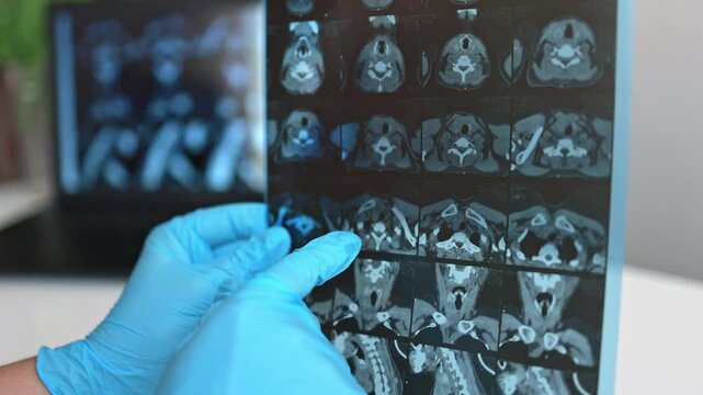 Computed tomography of the thyroid gland.