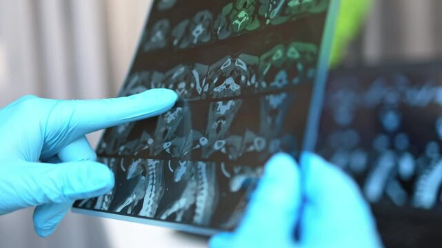 MRI image of the thyroid gland.