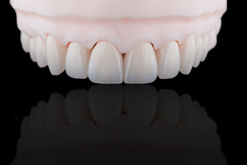 Quality dental zirconium crowns of upper jaw stylized as young teeth on 3D printed model.
