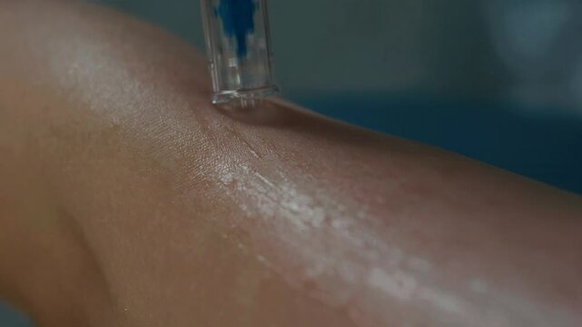 Cosmetologist's hands in black gloves using Meso Pen on patient's skin.