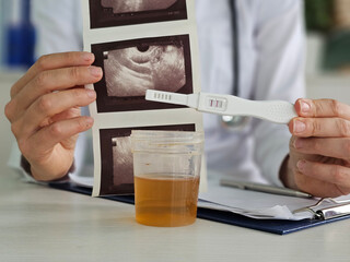 Gynecologist ultrasound images of embryo with positive pregnancy test and urine. Positive tests, no fetal egg on ultrasound