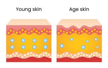 Differences Between Young and Old Skin