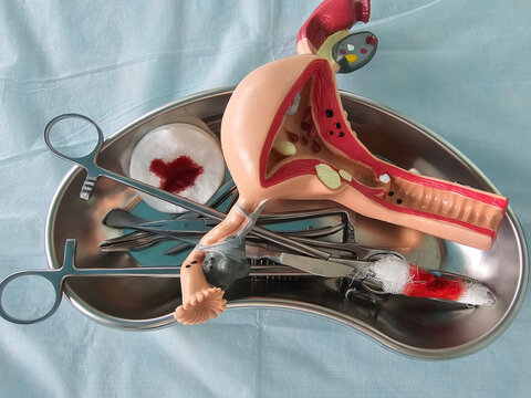 Surgery of genital organs of the uterus and ovaries in women.