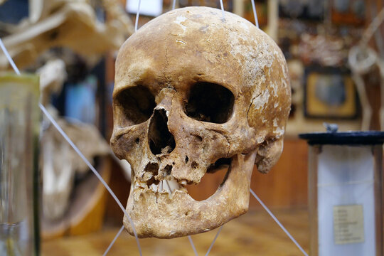 Bones of human skull for studying. Human skull