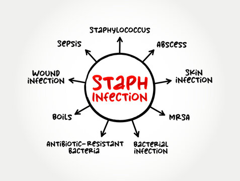 Staph Infection - are caused by staphylococcus bacteria, mind map medical text concept background