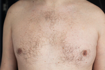 Naklejka premium A close-up photo of a mans chest, showcasing his light brown hair. The image shows fine, short hairs scattered across the chest, with a few freckles visible on the skin.