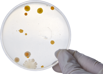 Bacterial Cultures in Petri Dishes in microbiology laboratory. Test various germs, virus, Coronavirus, Corona, COVID-19, Microbial population count, Food science.