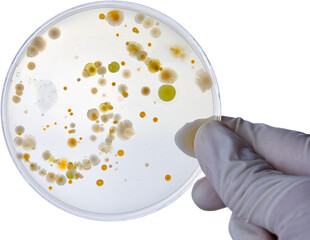 Bacterial Cultures in Petri Dishes in microbiology laboratory. Test various germs, virus,...