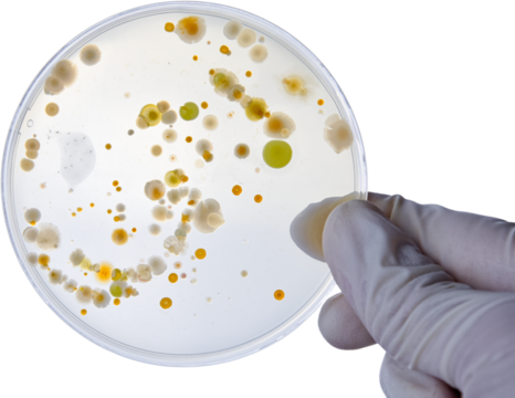 Bacterial Cultures in Petri Dishes in microbiology laboratory. Test various germs, virus, Coronavirus, Corona, COVID-19, Microbial population count, Food science.
