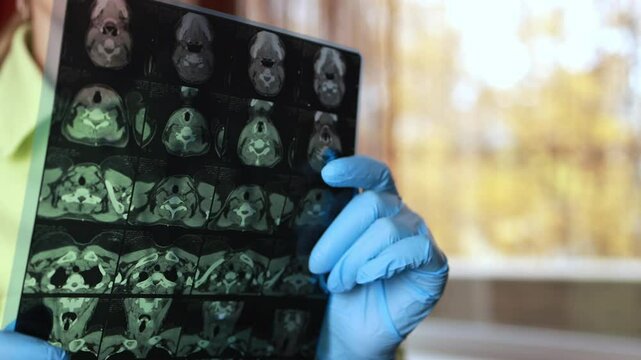 Computed tomography of the thyroid gland.