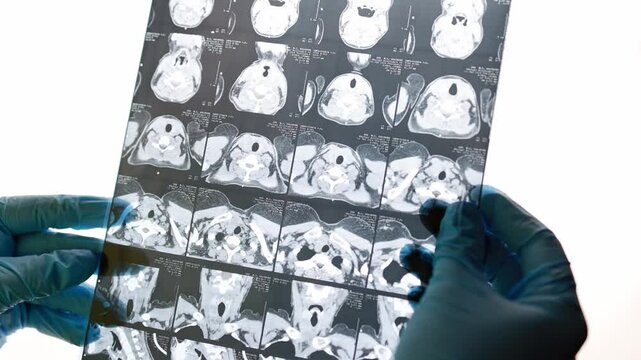 Computed tomography of the thyroid gland.