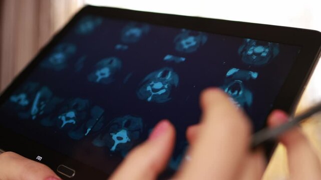 A doctor examines a computed tomography scan of the thyroid gland on a tablet. Online consultation with a doctor.