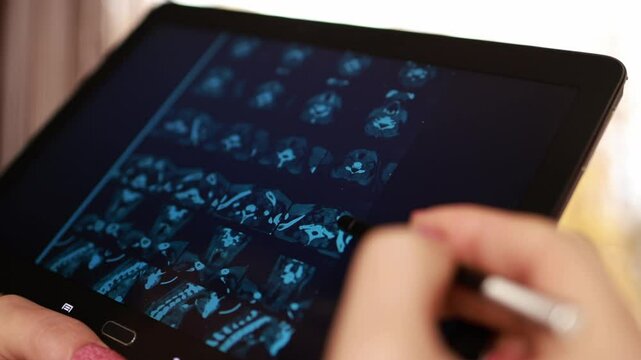 A doctor examines a computed tomography scan of the thyroid gland on a tablet. Online consultation with a doctor.