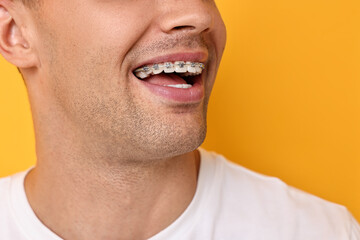 Obraz premium Happy man with dental braces on yellow background, closeup