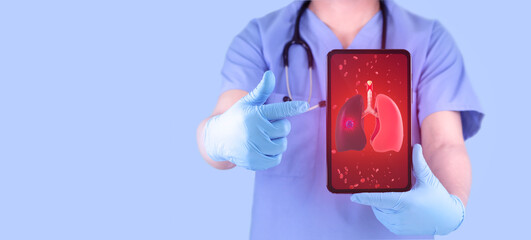 A pulmonologist doctor examines a lung with cancer through his tablet, isolated on a light blue...