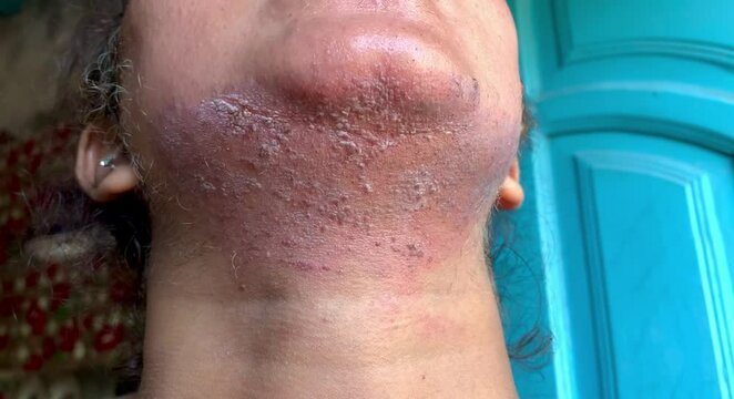 Skin concerns, common skin issues, dermatology, skin health problems, skincare, acne, eczema, sensitive skin, wrinkles, skin care routine, blemishes, aging, redness, skincare solutions, skin treatment