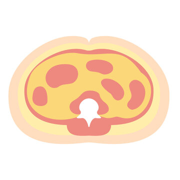 内臓脂肪の多い腹部の断面図