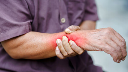Experiencing discomfort, individual holds their red, inflamed wrist, indicating possible injury or...