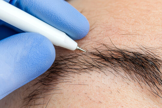 Professional tattooist who performs tricopigmentation